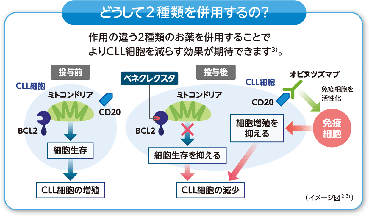 ベネクレクスタとオビヌツズマブの併用による作用イメージ図。作用の違う2種類のお薬を併用することで、よりCLL細胞を減らす効果が期待できます。
