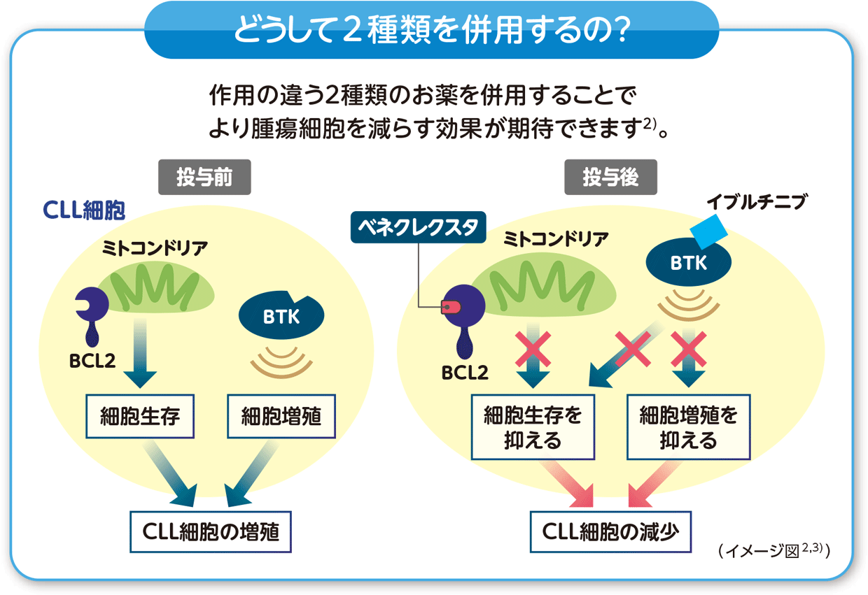ベネクレクスタとイブルチニブの併用による作用イメージ図。作用の違う2種類のお薬を併用することでより腫瘍細胞を減らす効果が期待できます。